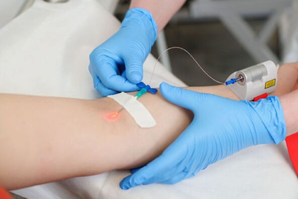 tratament intravenos cu laser pentru psoriazis pe picioare