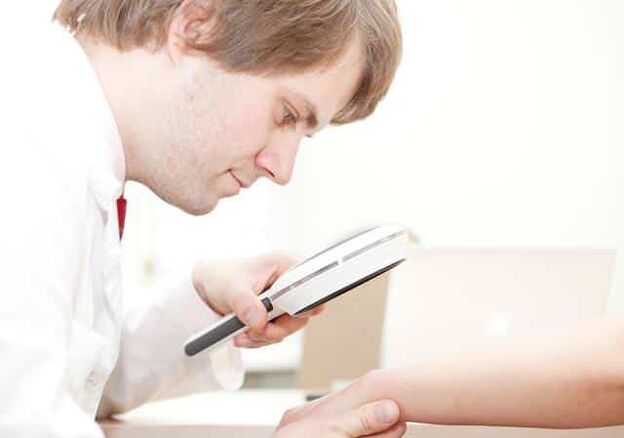 Diagnosticul psoriazisului de către un dermatolog