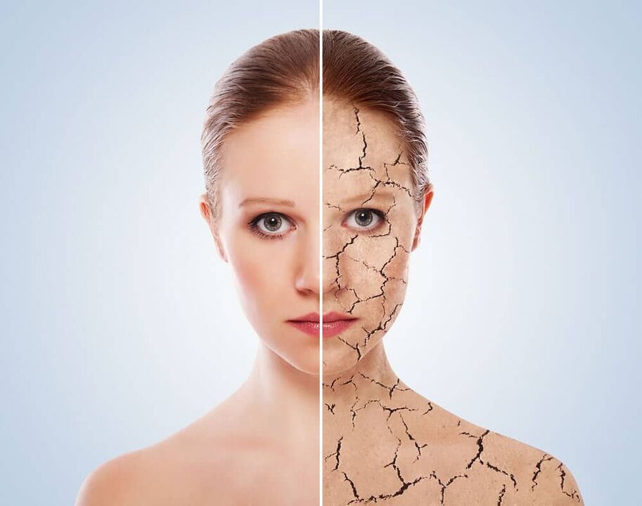 Piele sănătoasă și pielea afectată de psoriazis